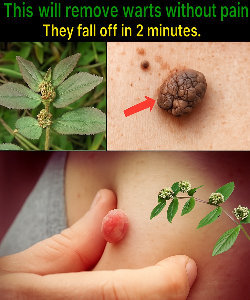 🌿 ¿Has probado esta hoja natural para el cuidado de la piel? Muchos la usan para tratar verrugas en casa