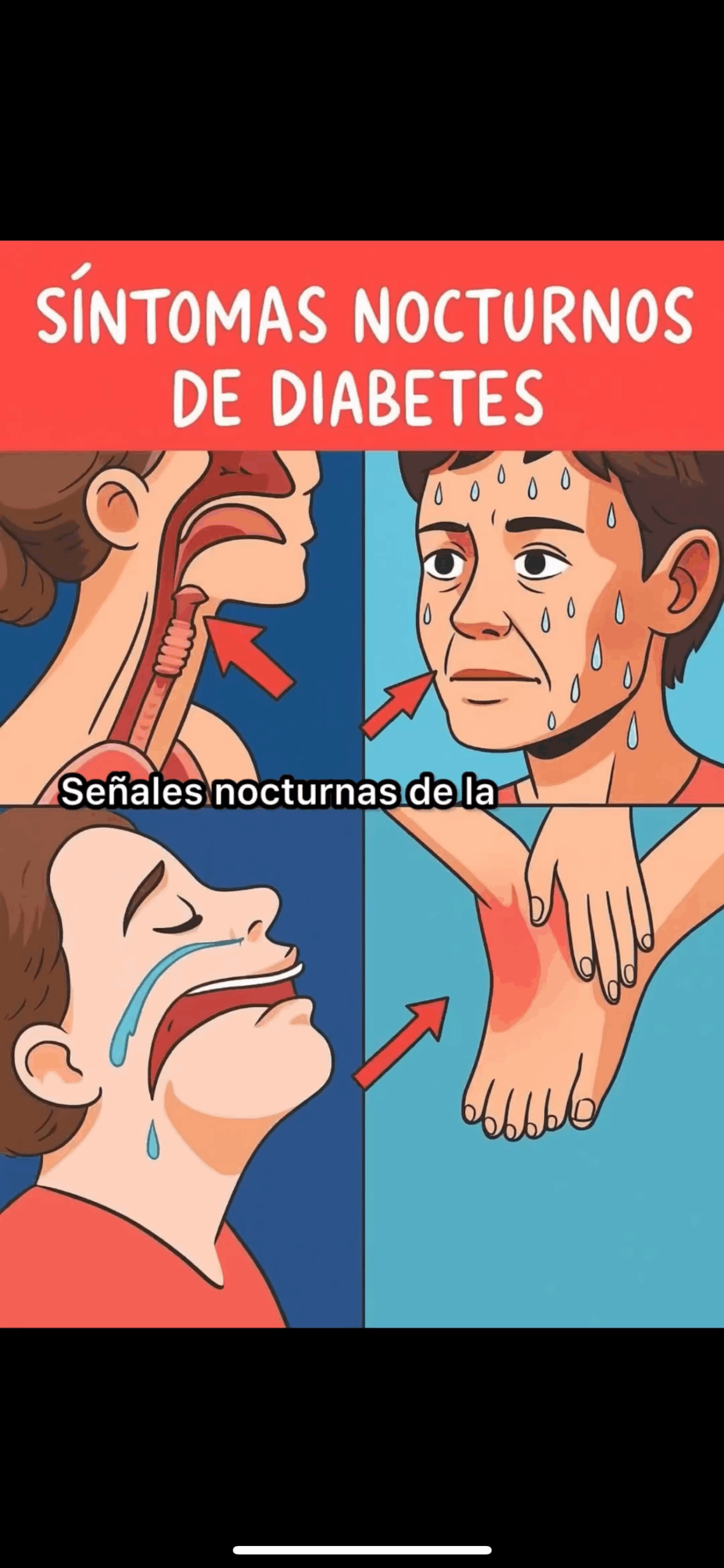 Señales Nocturnas De La Diabetes: Cómo Identificarlas Y Qué Hacer