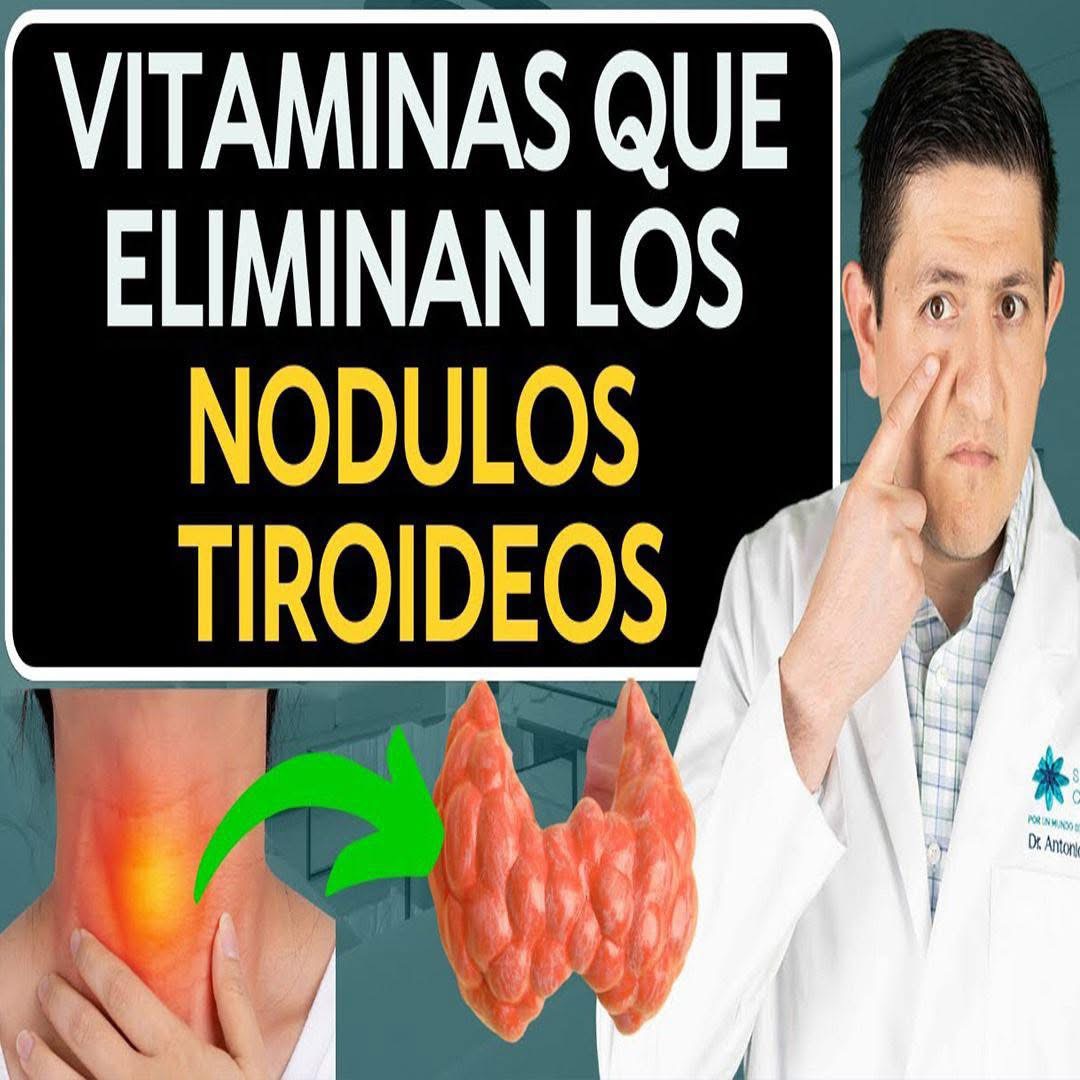 Cómo eliminar los nódulos tiroideos: lo que nadie te explica con claridad