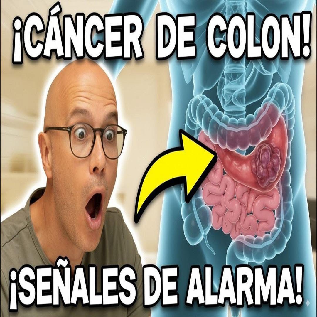 Señales tempranas de cáncer de colon que podrían salvar tu vida