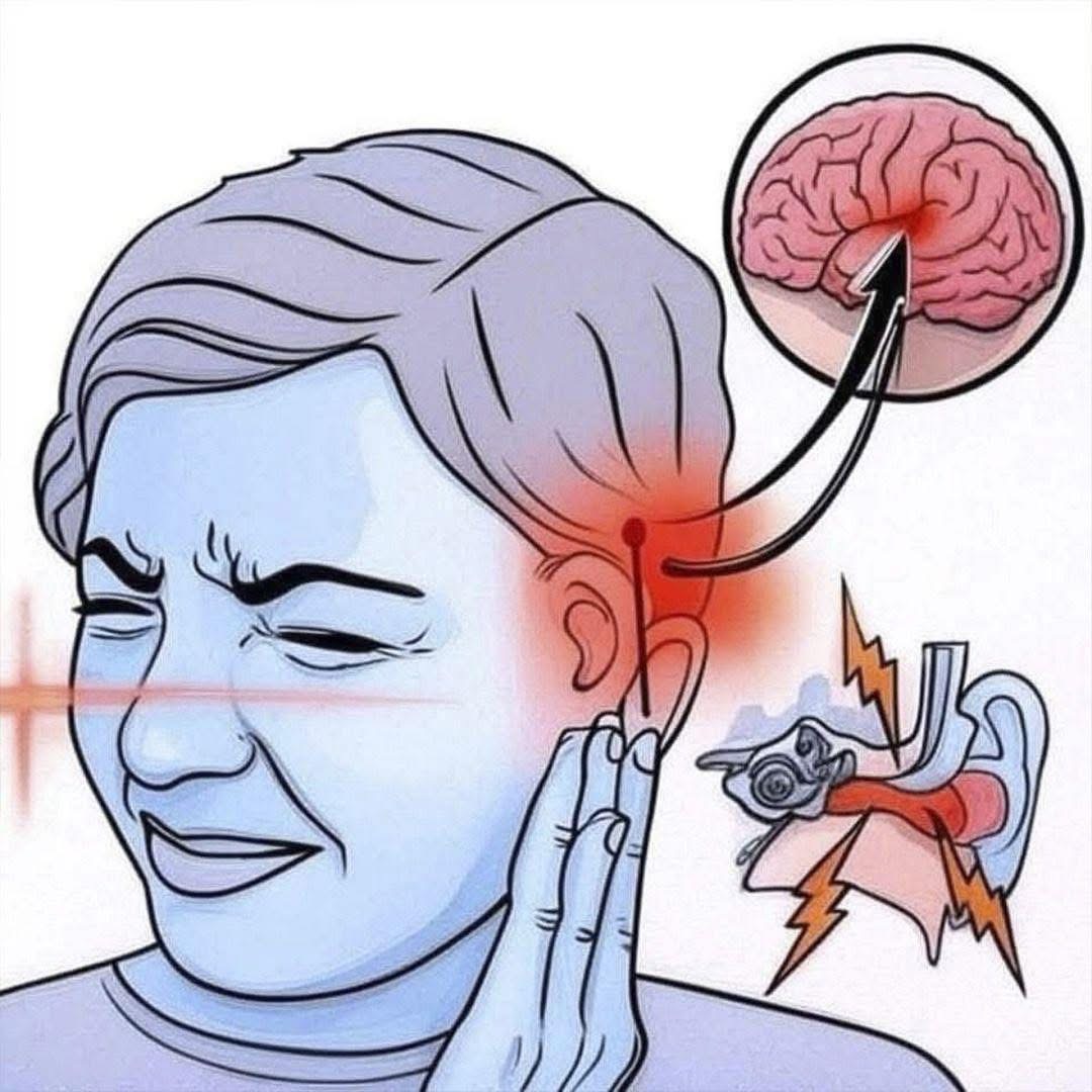 Si Oyes Zumbido En Tu Oído, Esta Es Una Señal De La