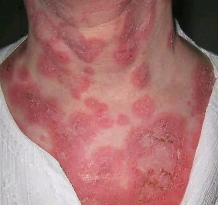 ATENCIÓN! SI TU PIEL SE VE ASÍ, PODRÍA SER POR UNA CAUSA QUE CASI NADIE IMAGINA