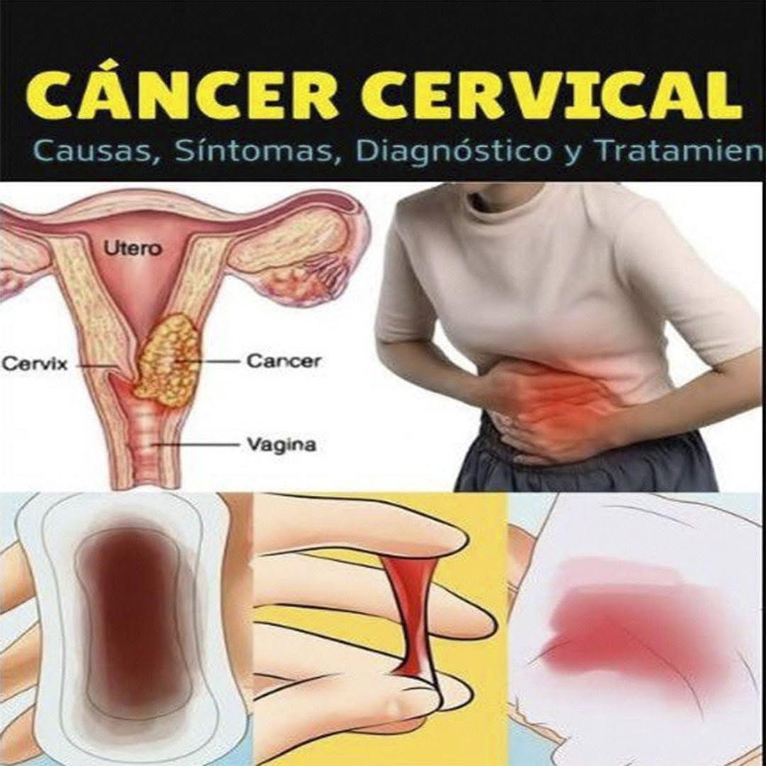 12 Señales de Advertencia de que Tu Útero Está Pidiendo Ayuda