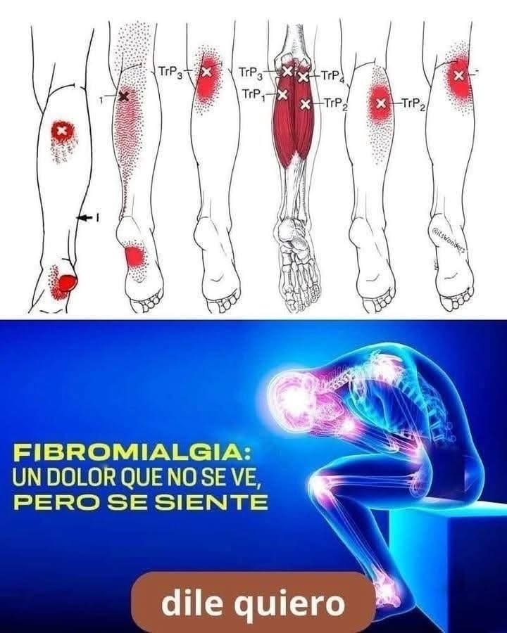 Fibromialgia: La Enfermedad de las Emociones No Expresadas Que Tu Cuerpo Termina Gritando