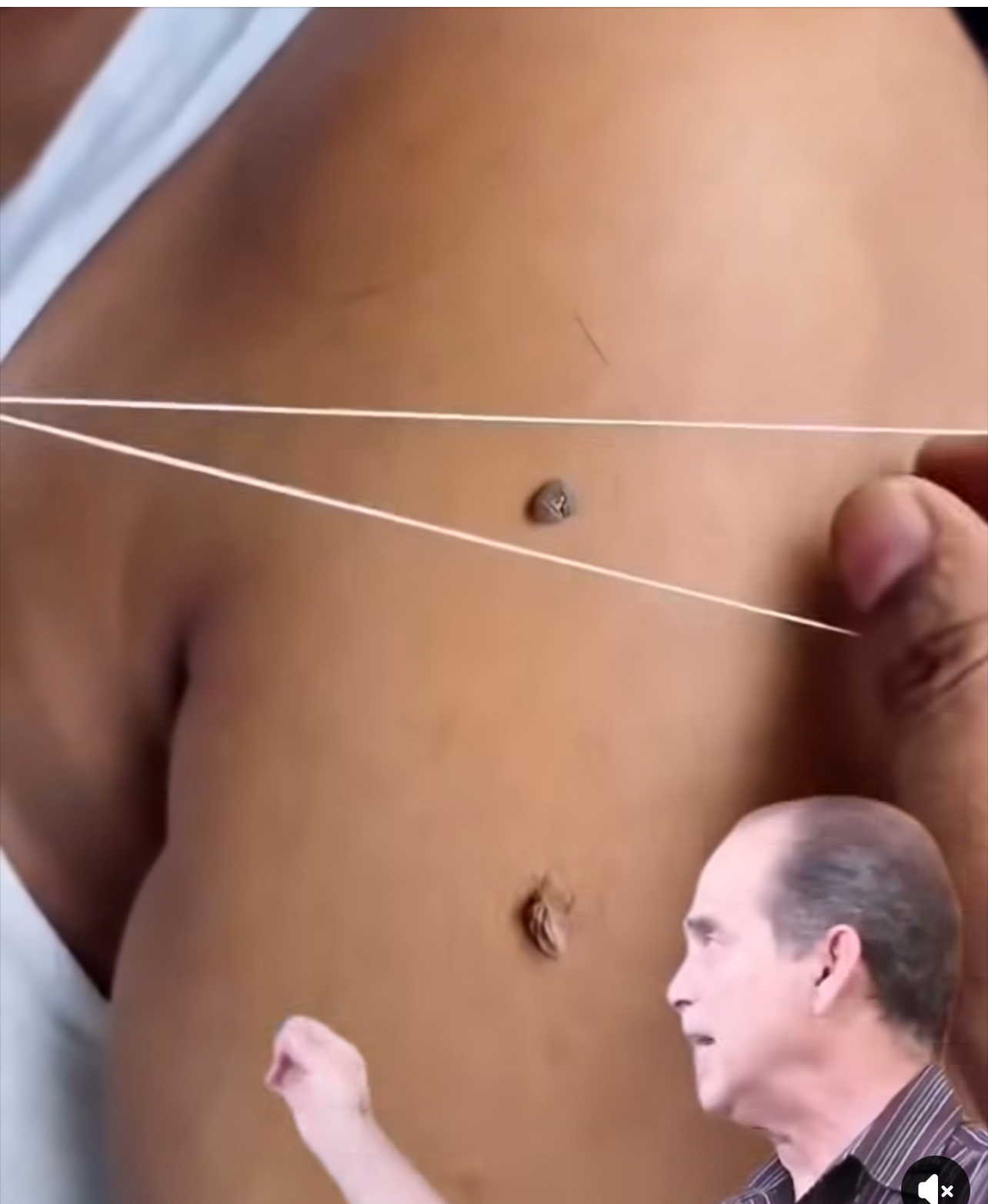 Un hisopo, 3 ingredientes… y la piel queda limpia y suave como nunca