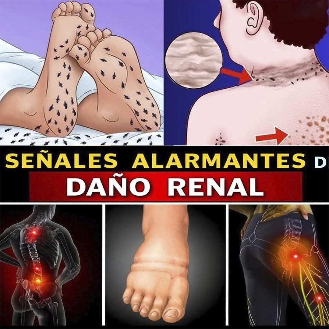 SEÑALES ALARMANTES DE DAÑO RENAL QUE NO DEBES IGNORAR