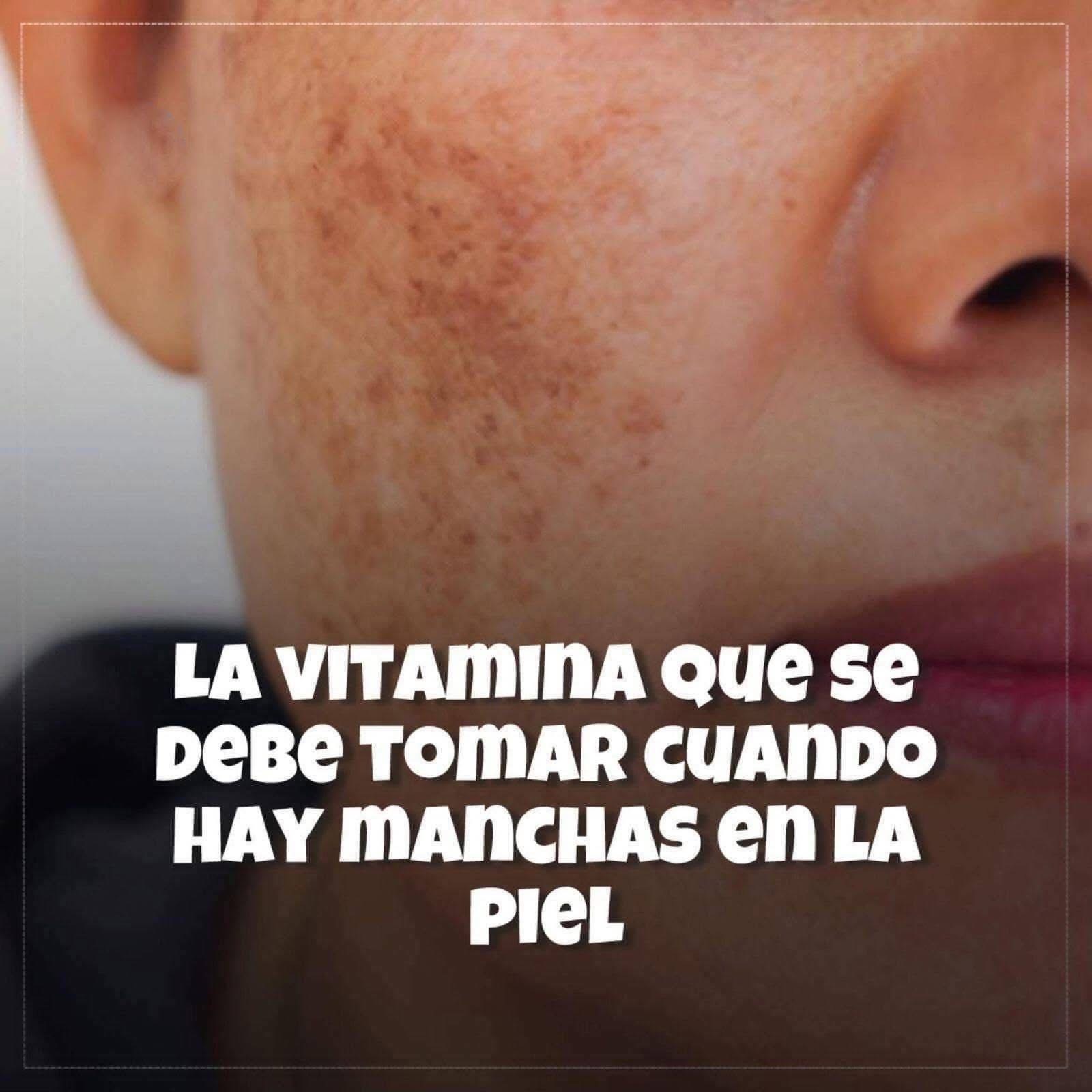 La Vitamina Que Debes Tomar Cuando Aparecen Manchas en la Piel