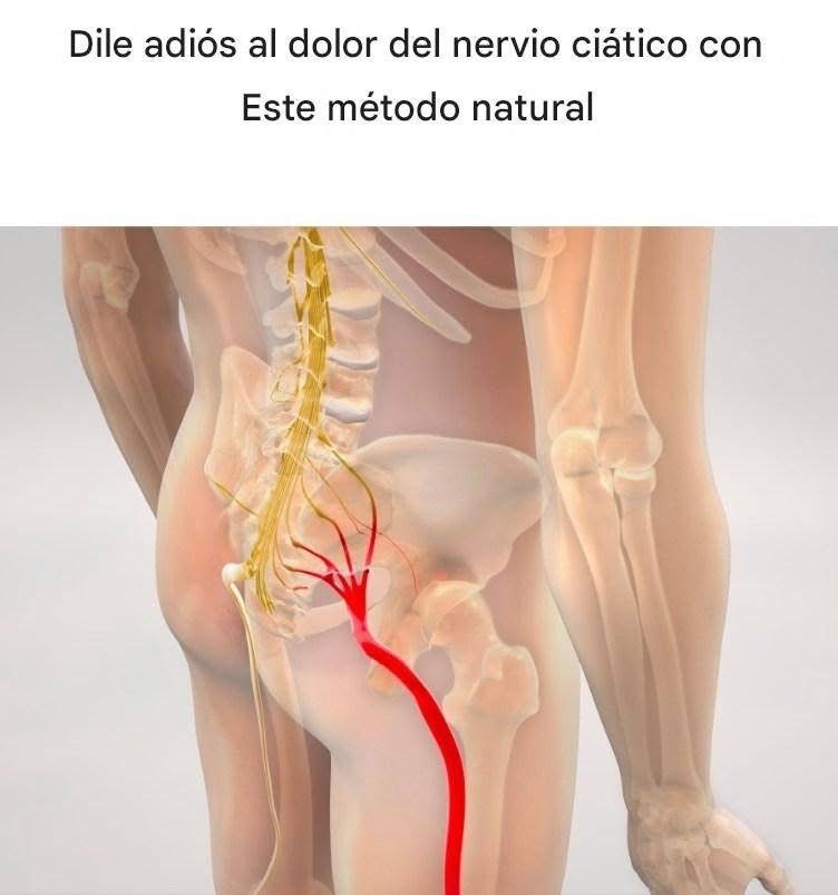 Dile adiós al dolor del nervio ciático con este método natural