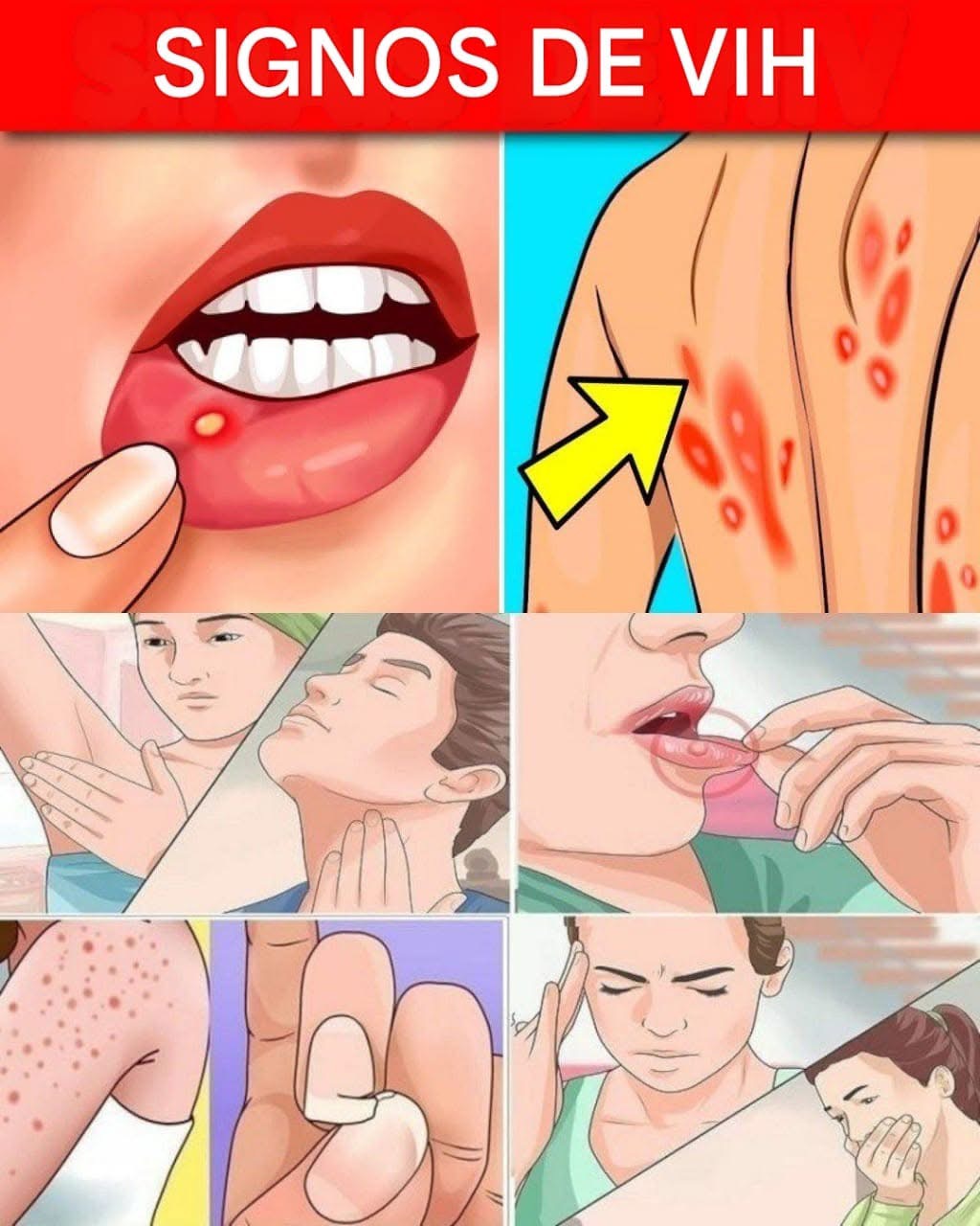 10 síntomas de que podrías estar infectado con VIH y que nunca debes ignorar