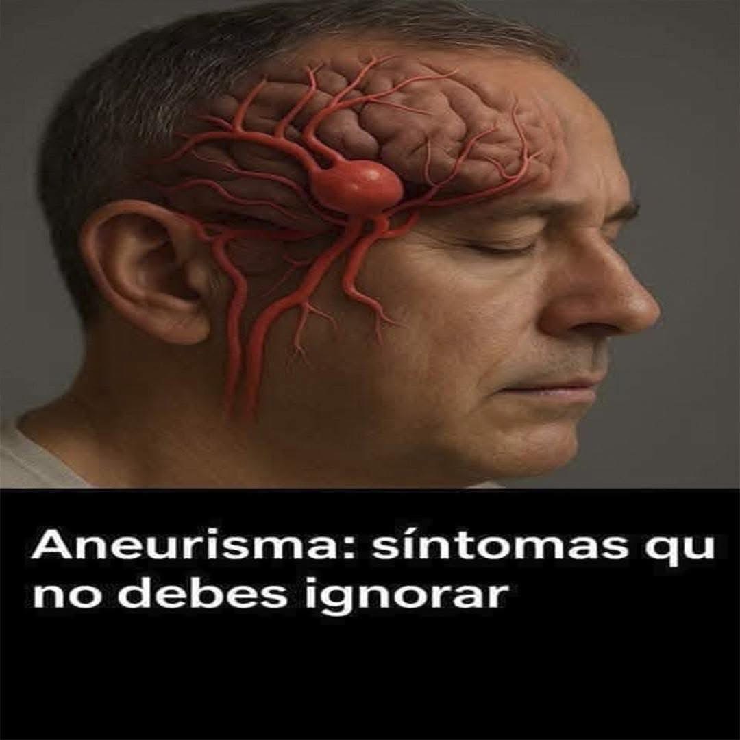 Aneurisma: Síntomas que No Debes Ignorar
