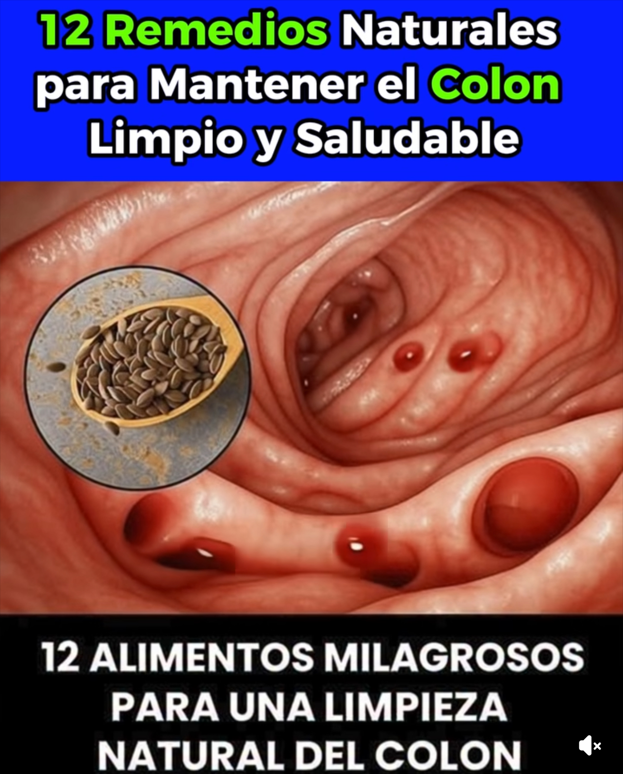 12 Formas Naturales de Mantener tu Colon en Óptimas Condiciones