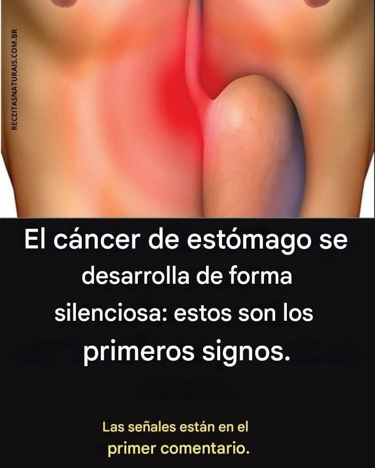 El cáncer de estómago se desarrolla silenciosamente: ¡estos son los primeros signos que no debes ignorar