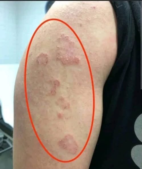 ESTOS SON LOS PRIMEROS SÍNTOMAS QUE NO DEBES IGNORAR