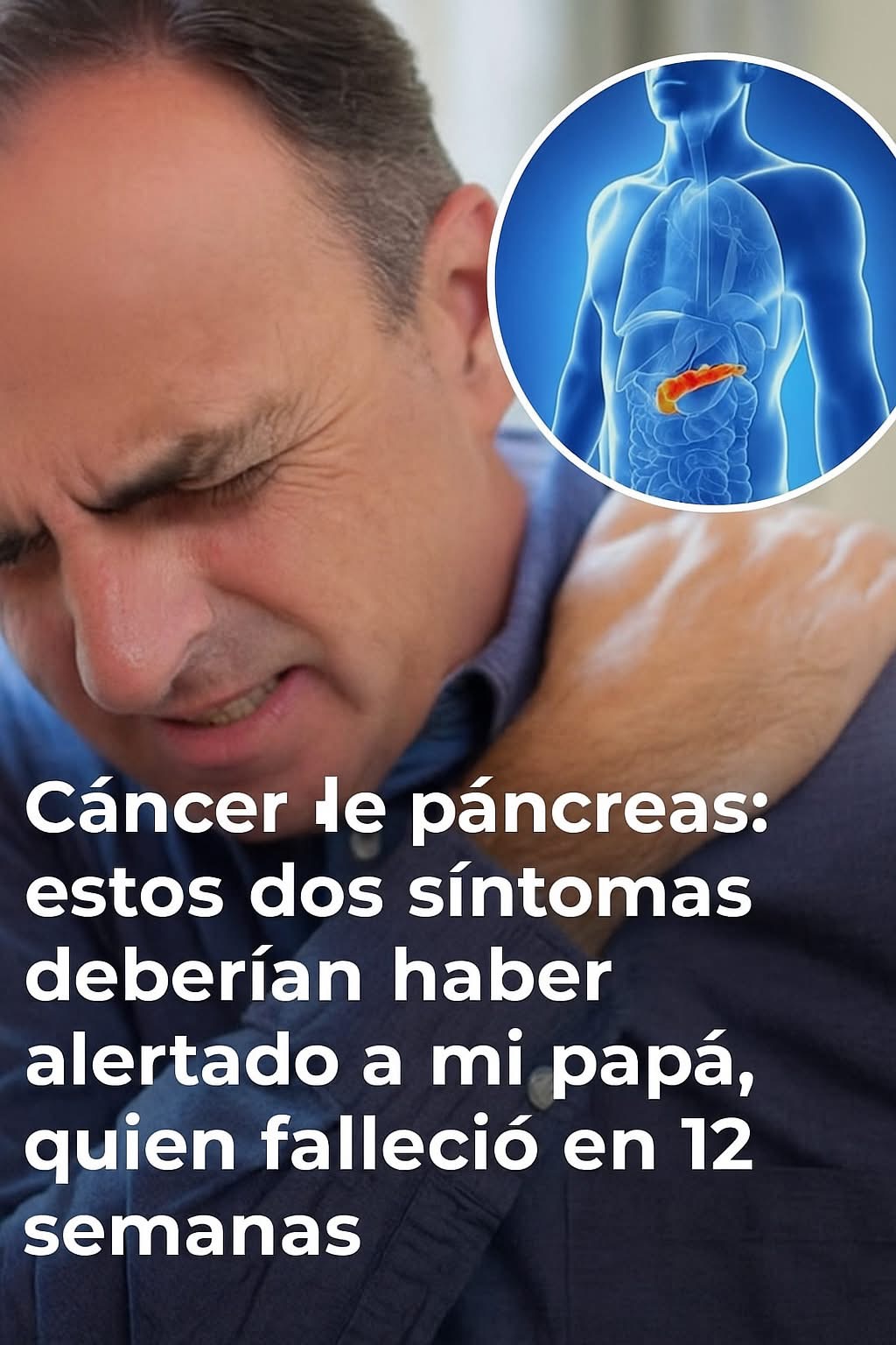 Cáncer de páncreas: estos 10 signos que pueden ayudarte a detectarlo