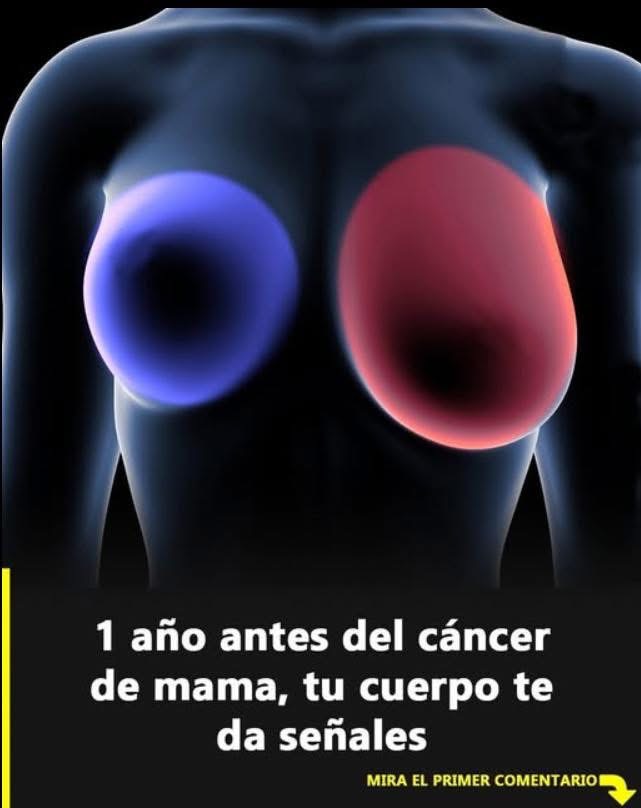 Estos son los 4 signos tempranos del cáncer de mama que NO debes ignorar