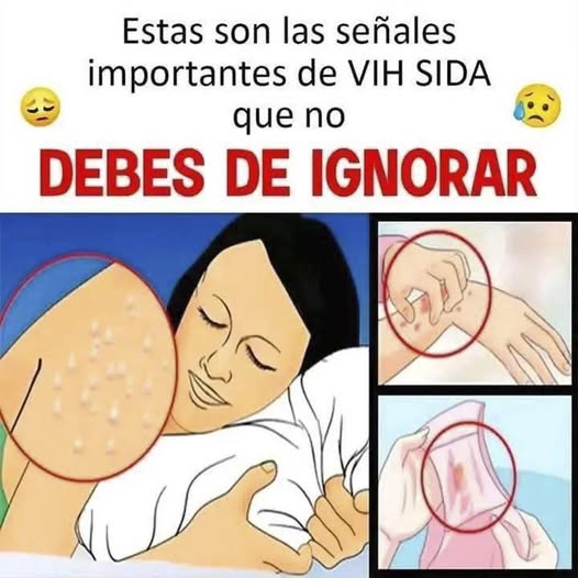 ¿Podrías estar infectado con VIH sin saberlo? Descubre lo que tu cuerpo puede estar intentando decirte