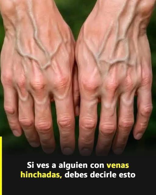 ¿Por qué se ven tus venas más de lo normal? Lo que tu cuerpo podría estar tratando de decirte