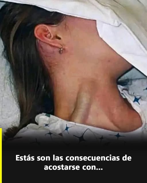 Distensión Yugular Masiva: Causas, Diagnóstico y Tratamiento