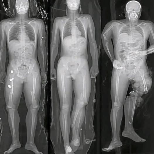 Si te pusiste la vacuna del COVID debes saber esto