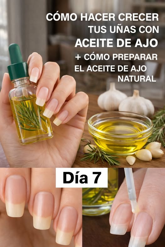¡De Uñas Cortas, Débiles y Quebradizas a LARGAS, FUERTES y PERFECTAS en Solo 10 Días! El Truco del Ajo que Miles de Mujeres Mayores de 50 Están Usando para Tener Manicura de Salon Sin Gastar un Euro
