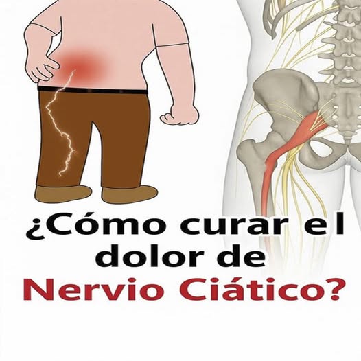 Soluciones efectivas para el dolor del nervio ciático