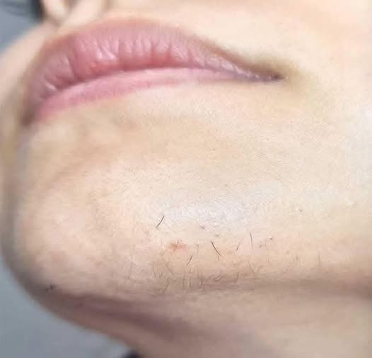 ¿Para qué sirve realmente la pasta de dientes en la piel? Mitos, riesgos y usos que sí funcionan (y cuáles NO)