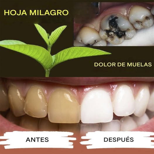 Cómo blanquear los dientes y prevenir las caries de forma natural: trucos y consejos que realmente funcionan