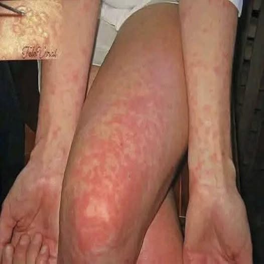 MEJOR SERA QUE SEPAS ESTO SI TIENES UNO DE ESTOS PUNTOS ROJOS EN TU CUERPO