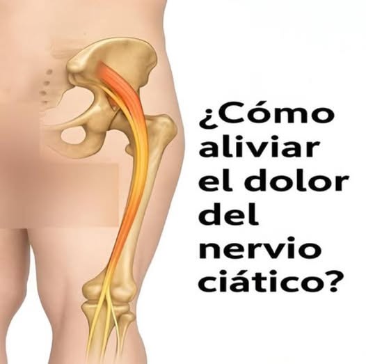 El Nervio Ciático: Alivio Real a Través de Técnicas Naturales y Conscientes