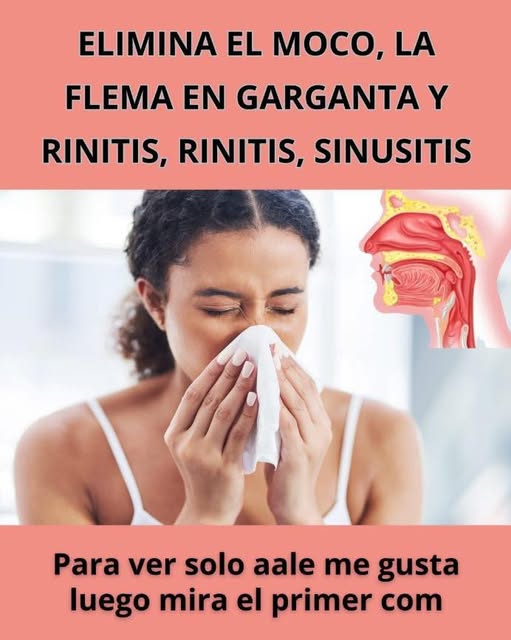 Remedios caseros para la influenza