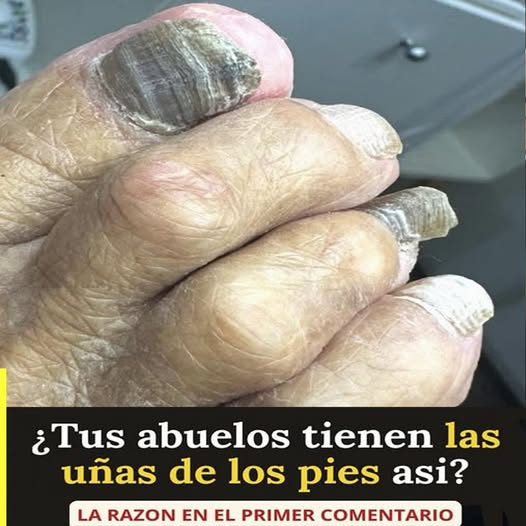 “Uñas de viejo”: qué significan estos cambios y por qué aparecen con el paso de los años