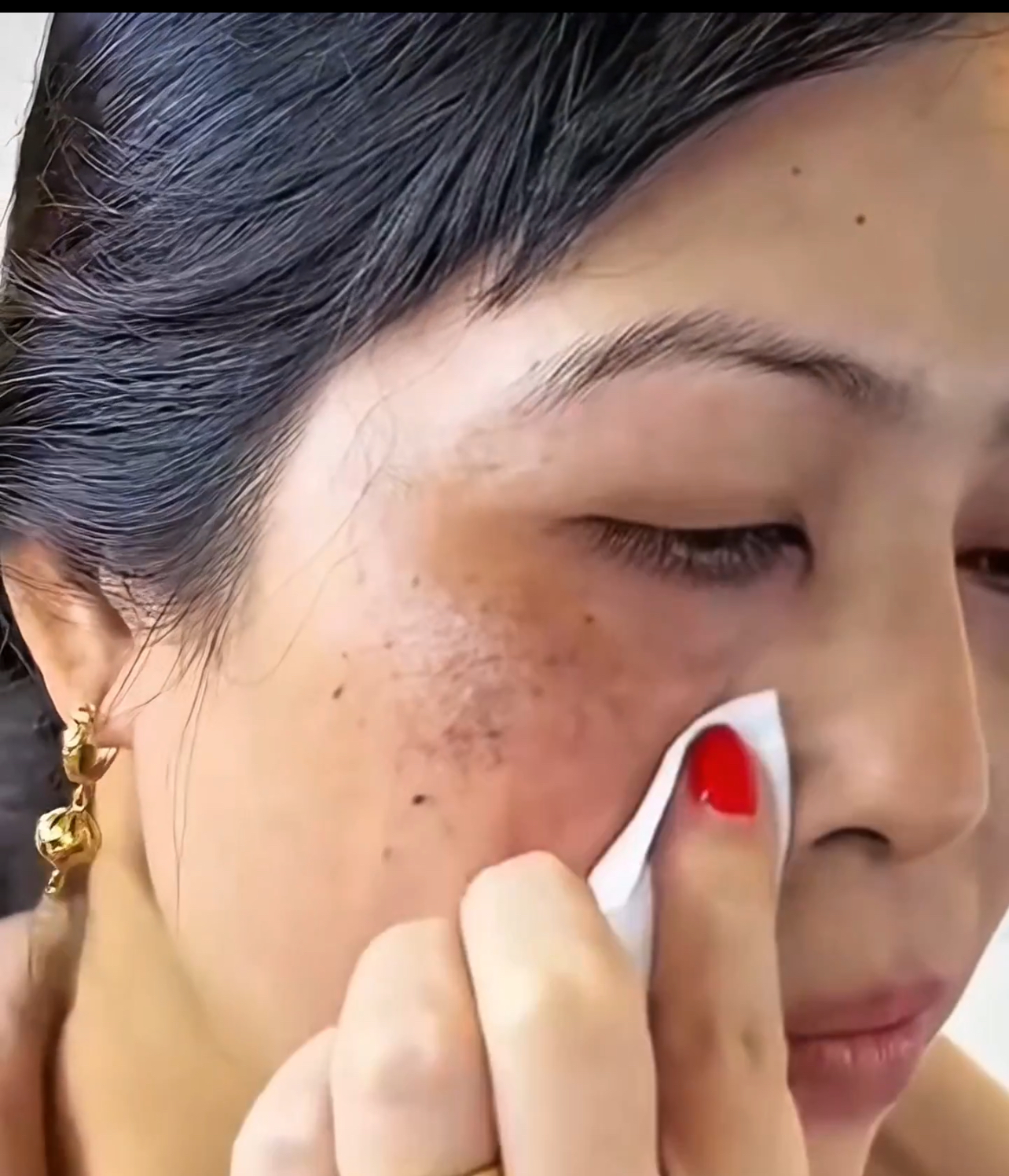 Así Logré Eliminar mis Manchas Oscuras del Rostro con una Mascarilla Casera