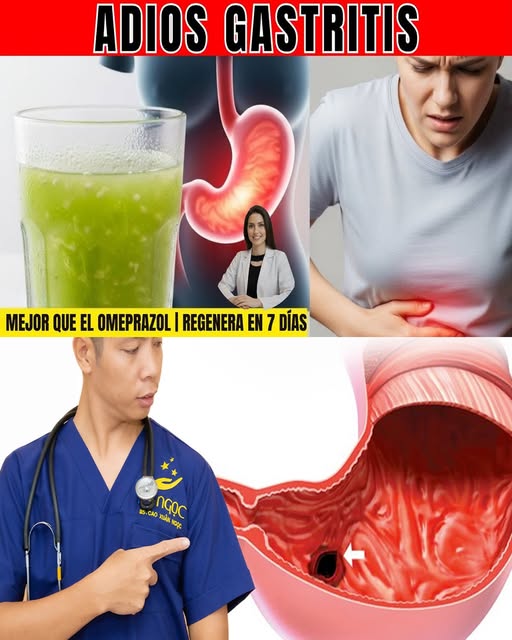 Si tu estómago arde por gastritis, prueba esta bebida con estrategia