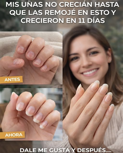 Uñas largas en 10 días: el ritual con aceite de ajo que podría cambiar tus manos